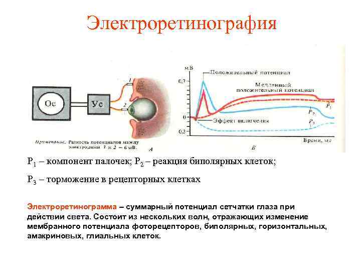 Электроретинография Р 1 – компонент палочек; Р 2 – реакция биполярных клеток; Р 3