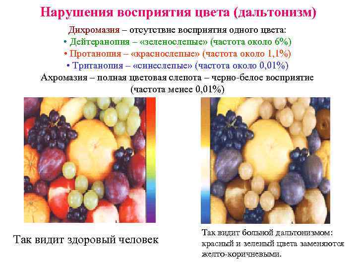 Нарушения восприятия цвета (дальтонизм) Дихромазия – отсутствие восприятия одного цвета: • Дейтеранопия – «зеленослепые»