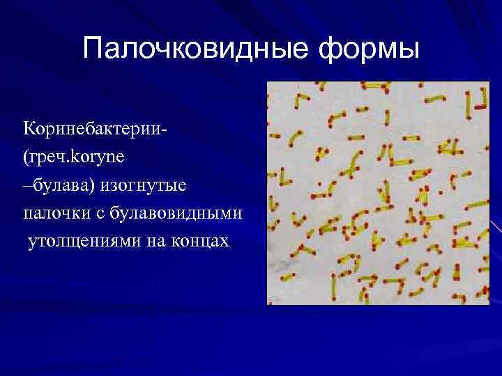 Палочковидные формы Коринебактерии(греч. koryne –булава) изогнутые палочки с булавовидными утолщениями на концах 