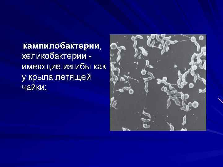 кампилобактерии, хеликобактерии имеющие изгибы как у крыла летящей чайки; 