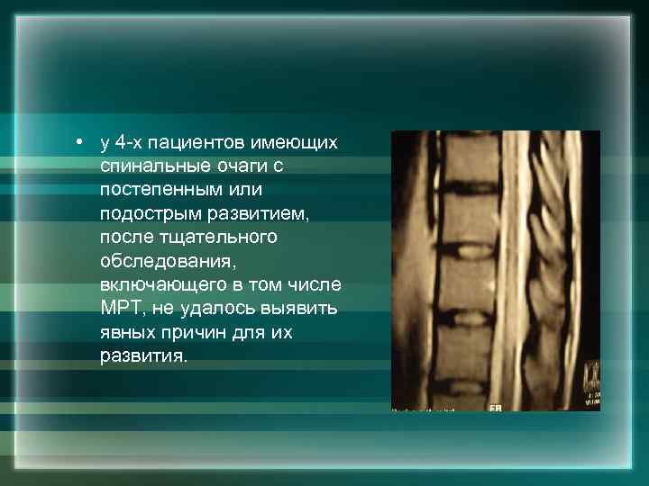  • у 4 -х пациентов имеющих спинальные очаги с постепенным или подострым развитием,