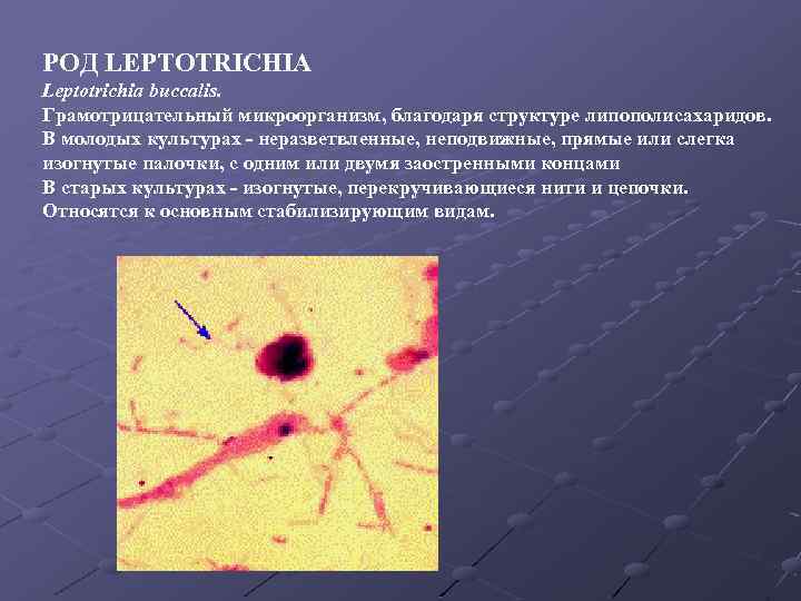 РОД LEPTOTRICHIA Leptotrichia buccalis. Грамотрицательный микроорганизм, благодаря структуре липополисахаридов. В молодых культурах - неразветвленные,