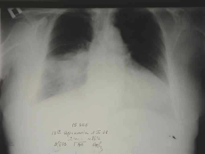    ФАКТОРЫ СВЯЗАННЫЕ С  НЕДОСТАТОЧНЫМ   КОНТРОЛЕМ ИНФЕКЦИИ  ПОТЕНЦИАЛЬНО