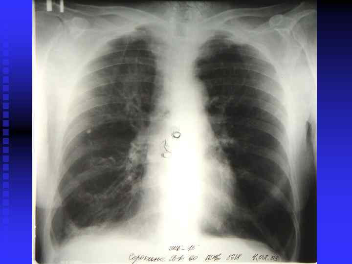 ФАКТОРЫ СВЯЗАННЫЕ С ЛЕЧЕБНЫМИ  ВМЕШАТЕЛЬСТВАМИ Ø  Седативные лекарственные препараты – подавляют ЦНС