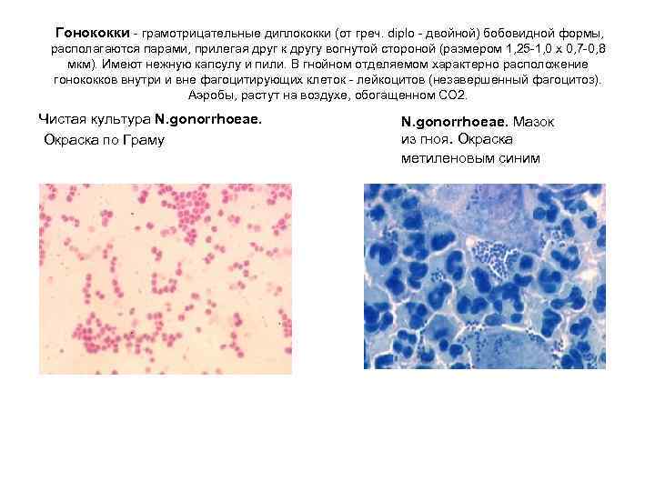  Гонококки - грамотрицательные диплококки (от греч. diplo - двойной) бобовидной формы, располагаются парами,