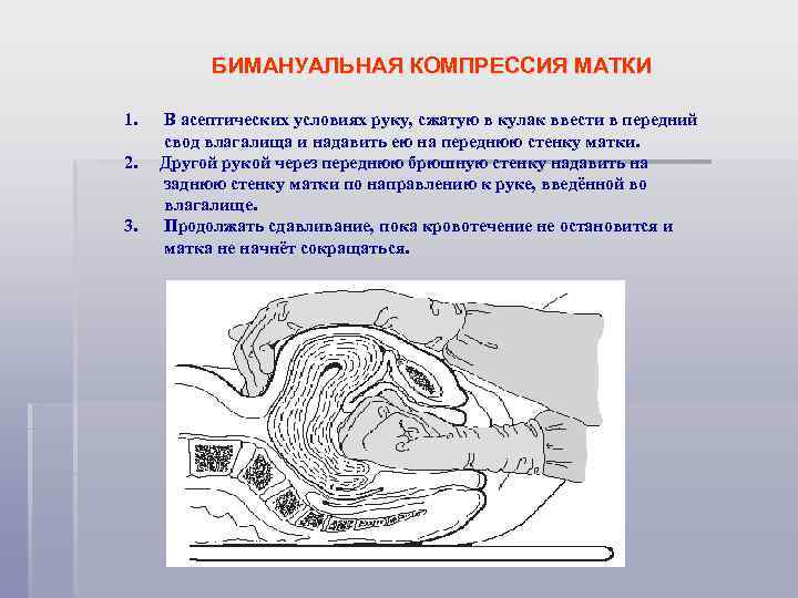 Бимануальное исследование