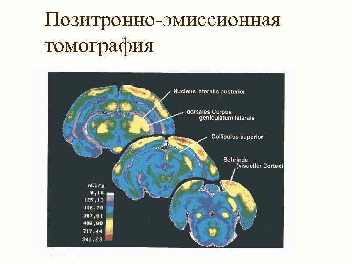 Позитронно-эмиссионная томография 