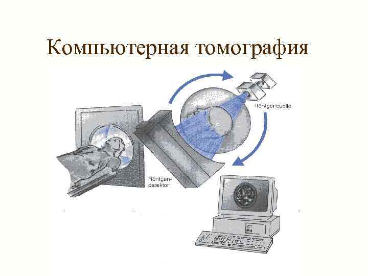 Компьютерная томография 
