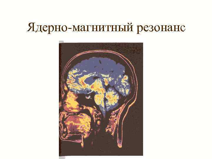 Ядерно-магнитный резонанс 