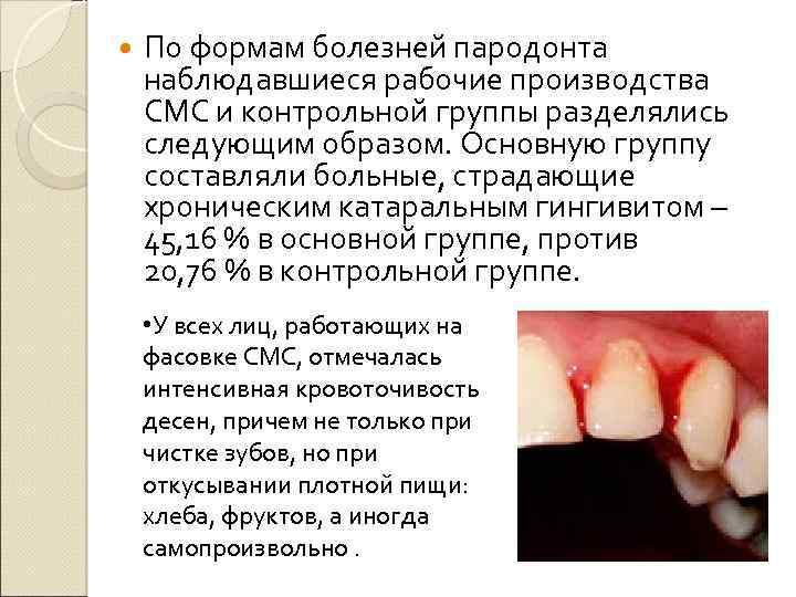  По формам болезней пародонта наблюдавшиеся рабочие производства СМС и контрольной группы разделялись следующим