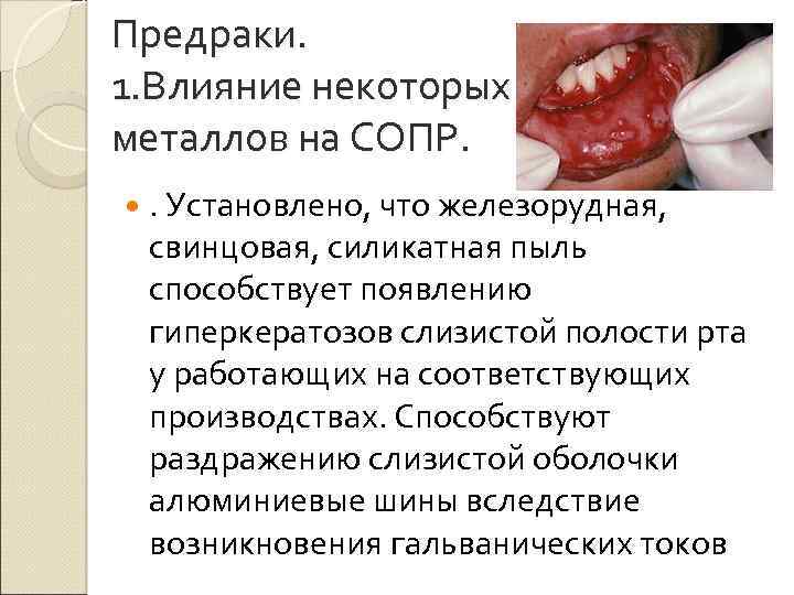 Предраки. 1. Влияние некоторых металлов на СОПР. . Установлено, что железорудная, свинцовая, силикатная пыль