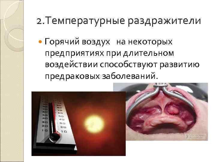 2. Температурные раздражители Горячий воздух на некоторых предприятиях при длительном воздействии способствуют развитию предраковых