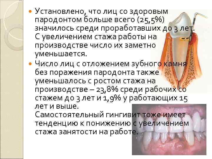 Установлено, что лиц со здоровым пародонтом больше всего (25, 5%) значилось среди проработавших до
