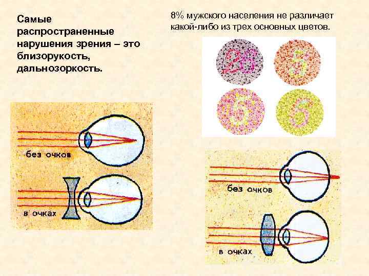 Самые распространенные нарушения зрения – это близорукость, дальнозоркость. 8% мужского населения не различает какой-либо