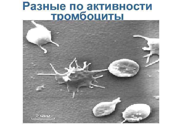 Разные по активности тромбоциты Перейти на первую страницу 