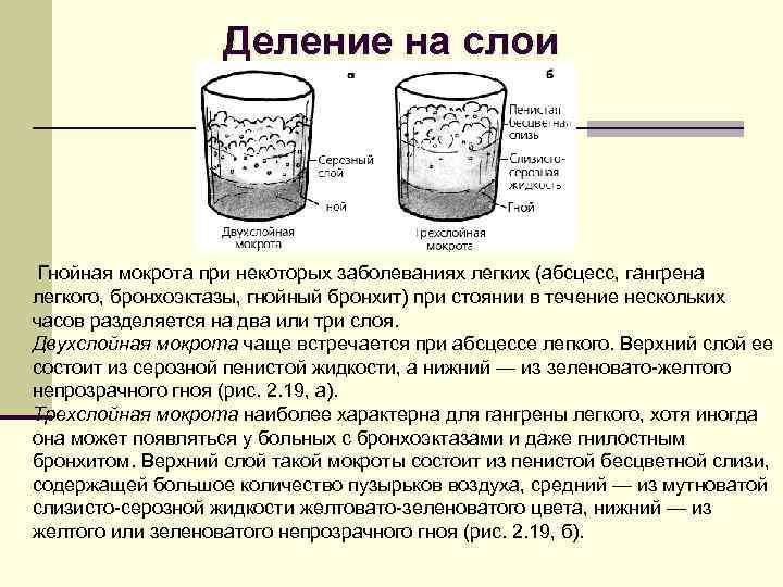 Слизисто гнойная мокрота фото