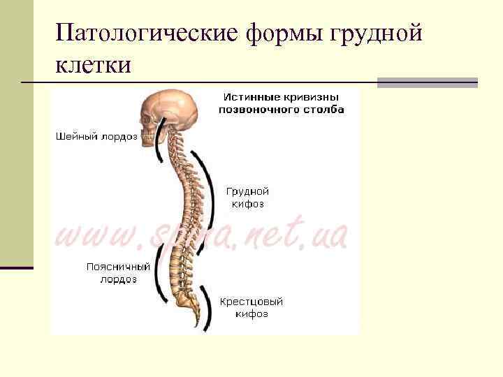 Патологические формы грудной клетки 