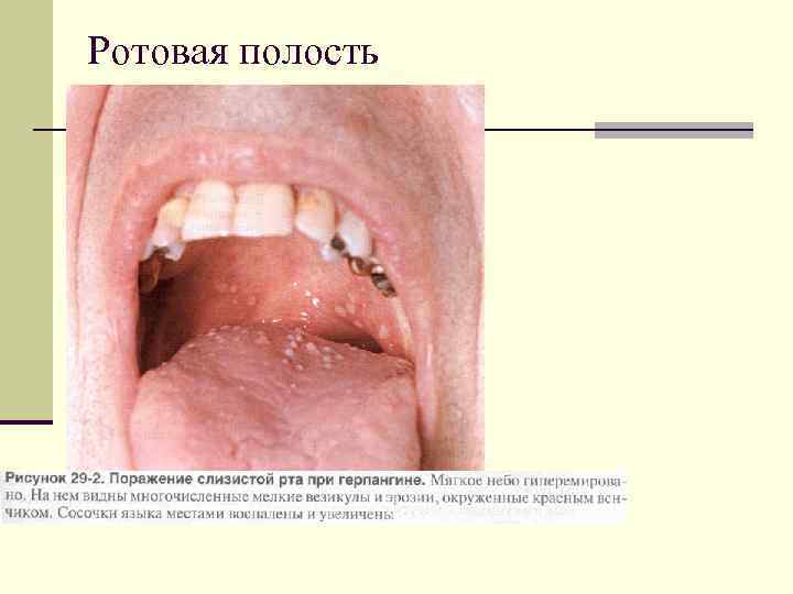Ротовая полость 