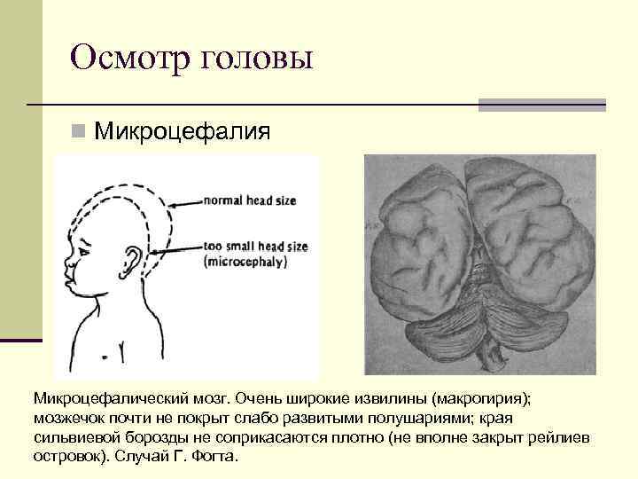 Осмотр головы