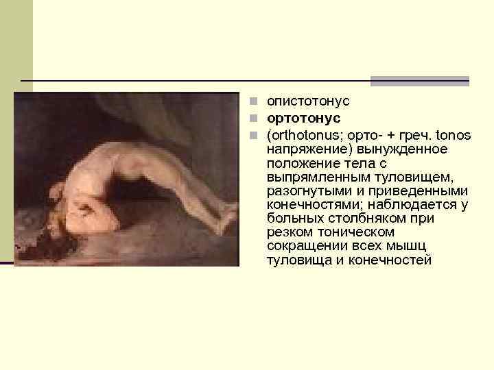 n опистотонус n ортотонус n (orthotonus; орто- + греч. tonos напряжение) вынужденное положение тела