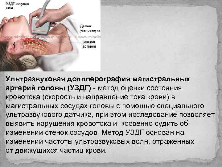 Ультразвуковая допплерография магистральных артерий головы (УЗДГ) - метод оценки состояния кровотока (скорость и направление