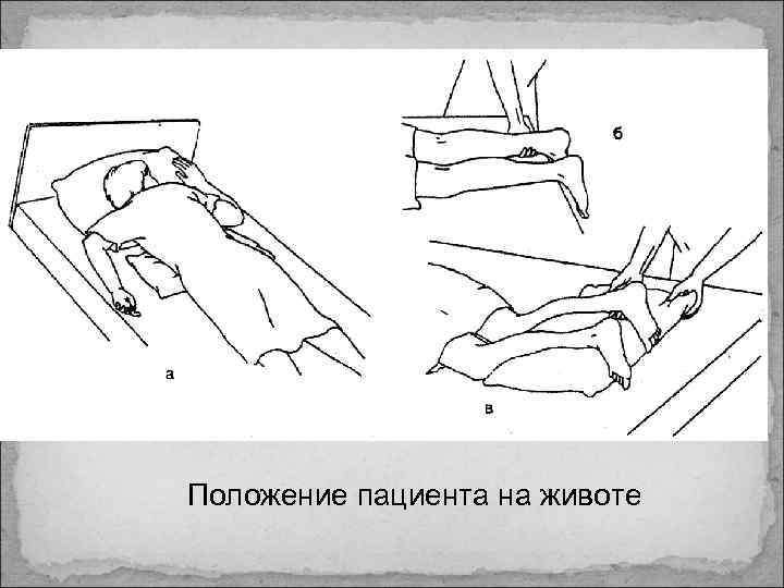 Положение пациента на животе 