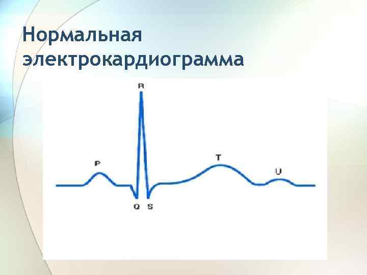Нормальная электрокардиограмма 