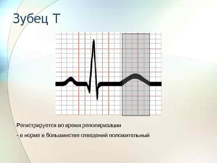 Зубец т. Двухфазный т зубец зубец. Зубец т отрицательный в норме. Анализ зубца т. Форма зубца т.