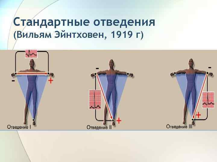 Стандартные отведения (Вильям Эйнтховен, 1919 г) 