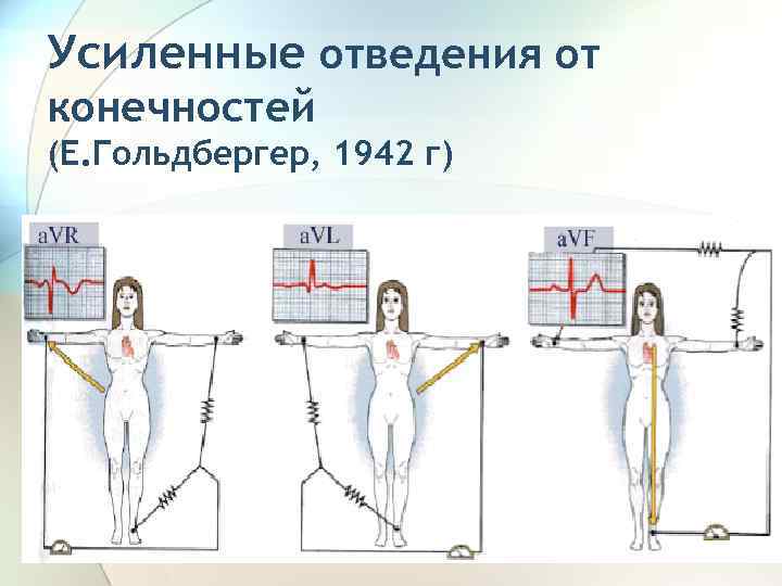 Усиленные отведения от конечностей (Е. Гольдбергер, 1942 г) 