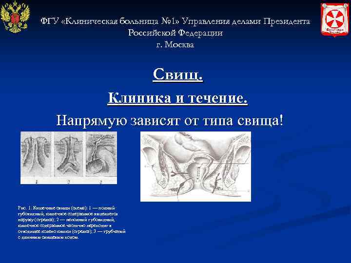ФГУ «Клиническая больница № 1» Управления делами Президента Российской Федерации г. Москва Свищ. Клиника