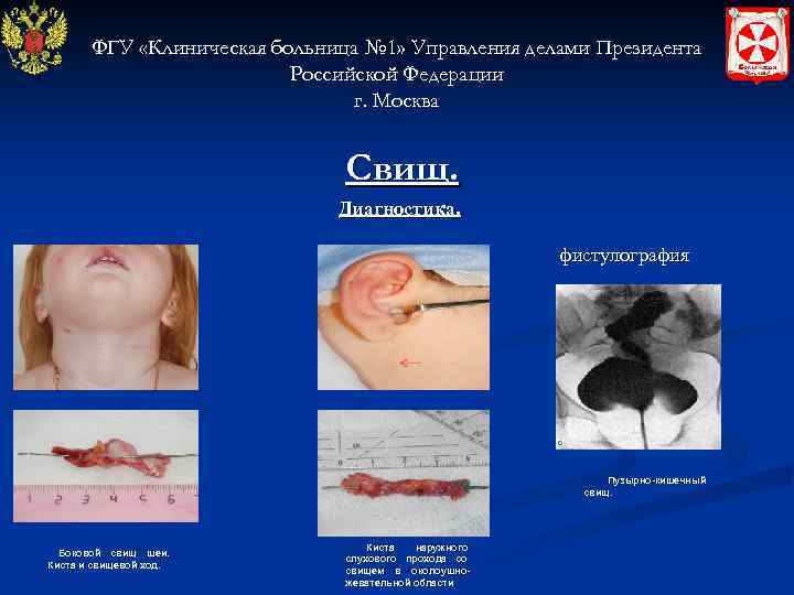 ФГУ «Клиническая больница № 1» Управления делами Президента Российской Федерации г. Москва Свищ. Диагностика.