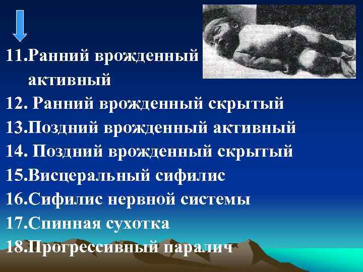 11. Ранний врожденный активный 12. Ранний врожденный скрытый 13. Поздний врожденный активный 14. Поздний