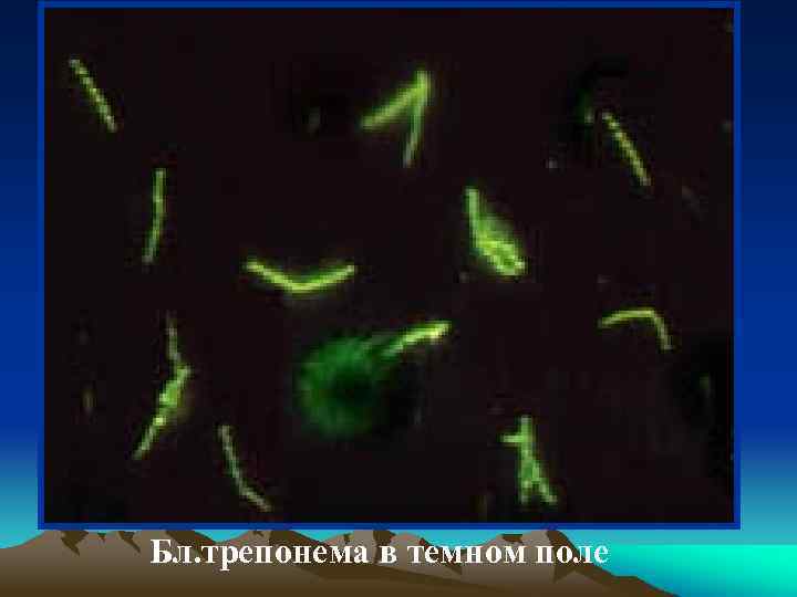 Бл. трепонема в темном поле 