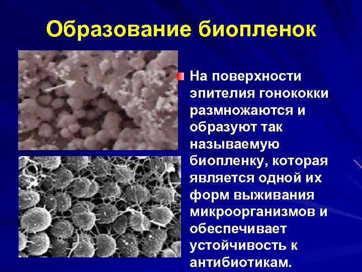 Образование биопленок На поверхности эпителия гонококки размножаются и образуют так называемую биопленку, которая является