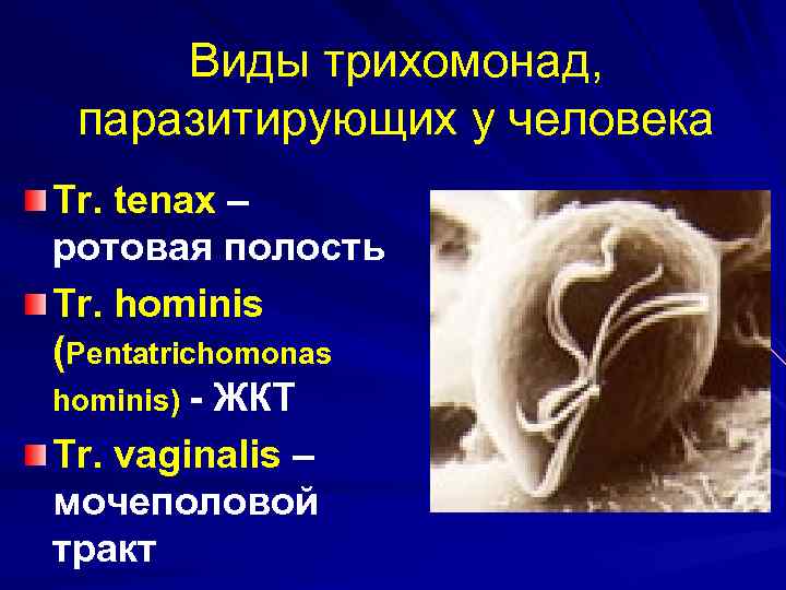 Трихомонада у женщин что это. Трихомонада микробиология. Ротовая трихомонада симптомы. Трихомонада Тенакс.