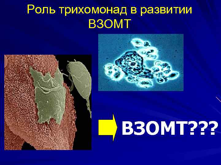 Роль трихомонад в развитии ВЗОМТ? ? ? 