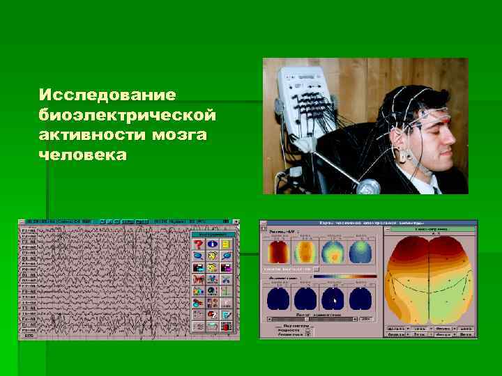 Исследование биоэлектрической активности мозга человека 