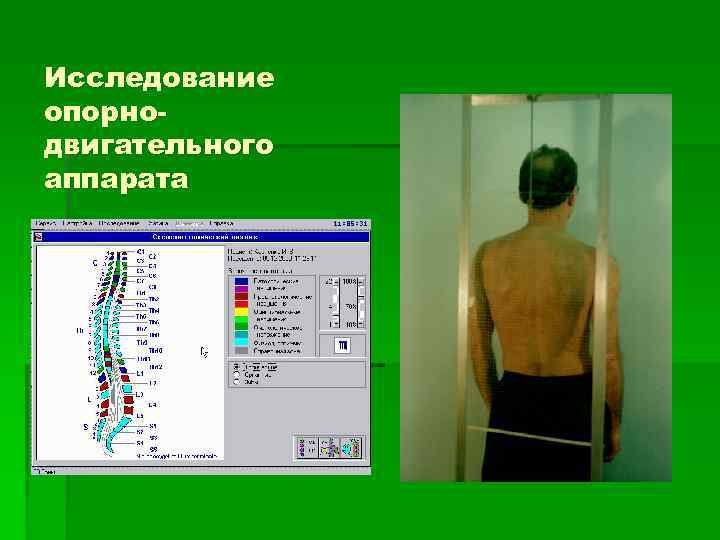 Исследование опорнодвигательного аппарата 