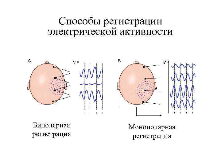 Способы регистрации электрической активности Биполярная регистрация Монополярная регистрация 