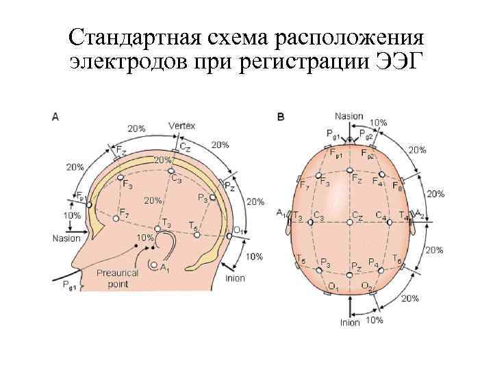 Стандартная схема расположения электродов при регистрации ЭЭГ 