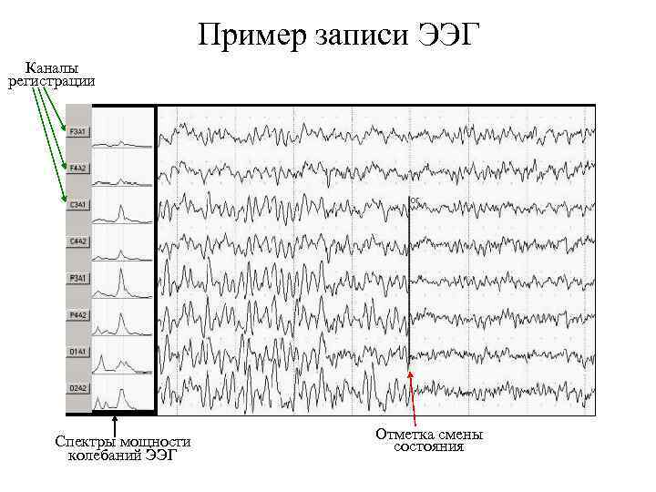 Пример записи ЭЭГ Каналы регистрации Спектры мощности колебаний ЭЭГ Отметка смены состояния 