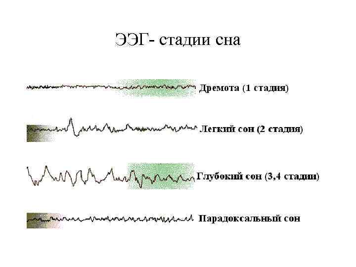 ЭЭГ- стадии сна 