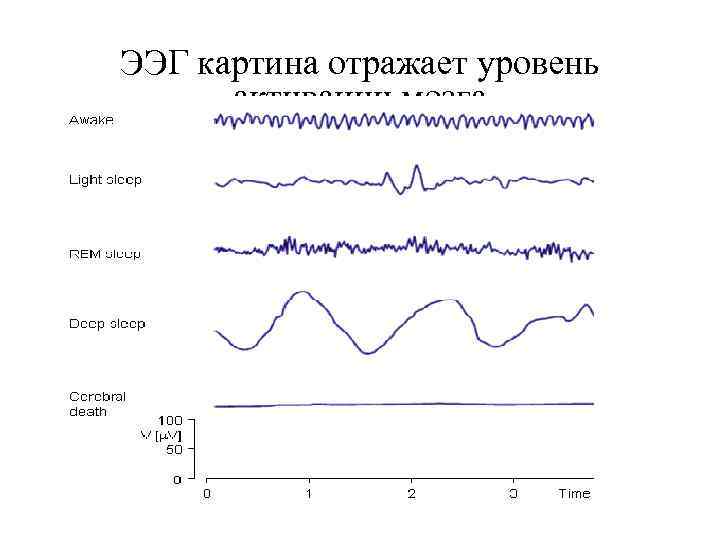 ЭЭГ картина отражает уровень активации мозга 