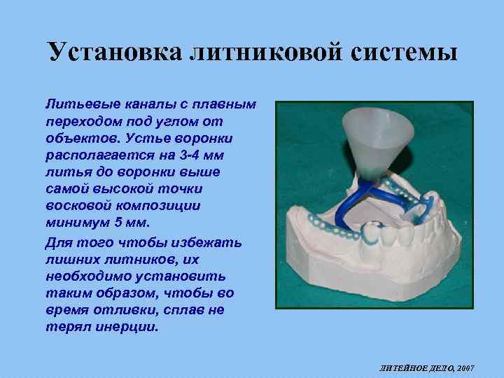 Литейное дело в стоматологии презентация