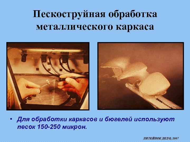 Пескоструйная обработка металлического каркаса • Для обработки каркасов и бюгелей используют песок 150 -250