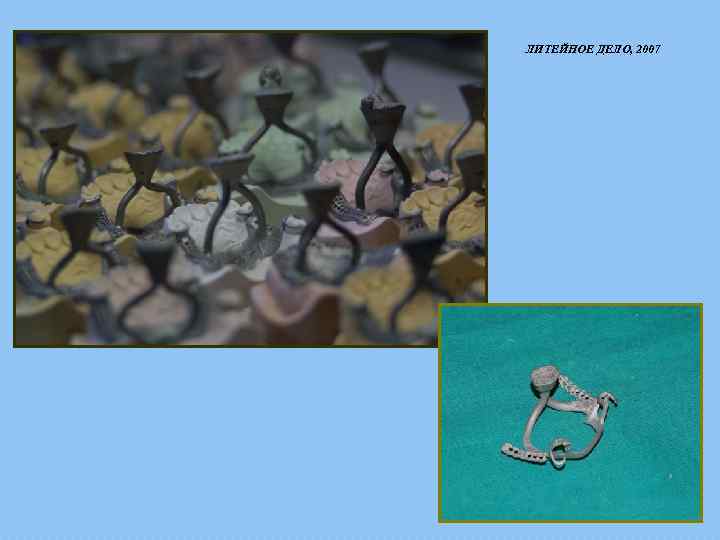 ЛИТЕЙНОЕ ДЕЛО, 2007 