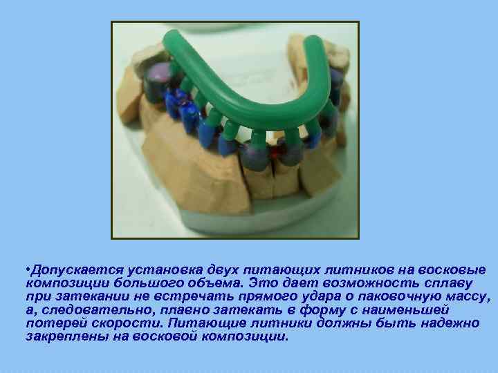 Литейное дело в стоматологии презентация