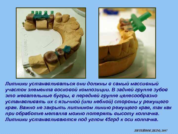 Литники устанавливаться они должны в самый массивный участок элемента восковой композиции. В задней группе