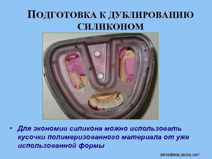 ПОДГОТОВКА К ДУБЛИРОВАНИЮ СИЛИКОНОМ • Для экономии силикона можно использовать кусочки полимеризованного материала от